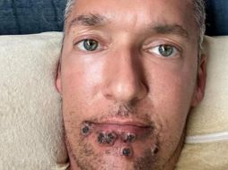 Silver Steele pidió compasión y amabilidad para todas las personas que están padeciendo la viruela del mono. TWITTER/@TheSilverSteele