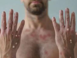 “¡Menos estigmas y más vacunas ya!”, es la directriz de esta manifestación. EL INFORMADOR/ Archivo