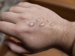 Debido al repunte de contagios a nivel nacional es necesaria la responsabilidad sanitaria por parte del gobierno. EL INFORMADOR/ Archivo