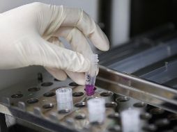 El paciente, un hombre de 45 años, había sido internado el miércoles con síntomas avanzados de viruela del mono. EFE/R. Yongrit