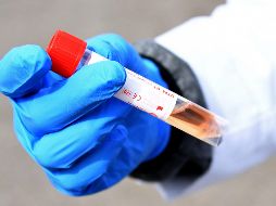 La ocupación de camas generales bajó un punto porcentual para ubicarse en 15 por ciento. AFP/ARCHIVO