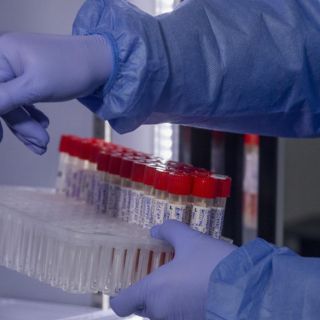 Detectan seis casos más de viruela del mono en Jalisco