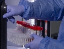 En Jalisco suman 28 casos de viruela del mono. Es la segunda entidad con más casos después de la Ciudad de México. ARCHIVO/ XINHUA