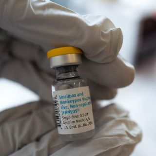 Viruela del mono: Estados Unidos maximiza vacuna contra el virus reduciendo dosis