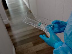 Hasta el momento estos serían los dos primeros casos que se detectan en el estado de Chihuahua de viruela del mono. AFP/J. Raedle