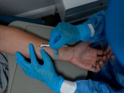 Hasta el momento, en Morelos se han descartado cuatro casos de viruela símica por parte de la federación. AFP/J. Raedle