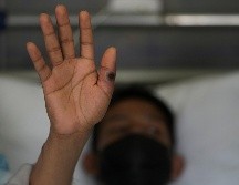 Casi todos los casos nuevos de viruela del mono se reportan en Europa y las Américas. AP/M. Mejía