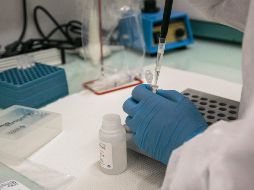 La viruela del mono es una enfermedad infecciosa rara que se propaga entre especies, incluso de animales a humanos. AFP / ARCHIVO