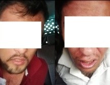 La aprehensión de los dos sujetos se dio en Calzada Juan Pablo II y Plutarco Elías Calles, en la colonia Oblatos. ESPECIAL /