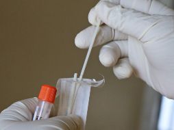 En la semana epidemiológica número 34, que comprende del 21 al 27 de agosto, se reportaron en promedio dos mil 116 contagios por día. ESPECIAL/Foto de Mufid Majnun en Unsplash