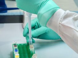 La viruela del mono tiene una duración promedio de 21 días y se transmite principalmente por contacto con personas enfermas. ESPECIAL/Foto de CDC en Unsplash