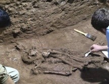 El corte en el hueso revela que fue intencional. TIM MALONEY