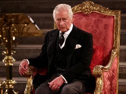 Él mismo ha bromeado al respecto, hablando de sus 