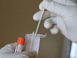 La infección es predominante en mujeres, con una media de edad de 38 años. ESPECIAL/Foto de Mufid Majnun en Unsplash