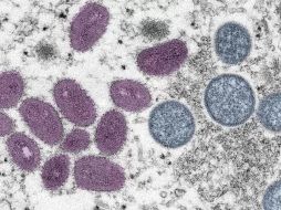 El principal medio de contagio es el contacto físico estrecho con otra persona que presente los síntomas, se recomienda precaución. EL INFORMADOR/ Archivo