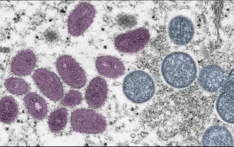 El principal medio de contagio es el contacto físico estrecho con otra persona que presente los síntomas, se recomienda precaución. EL INFORMADOR/ Archivo