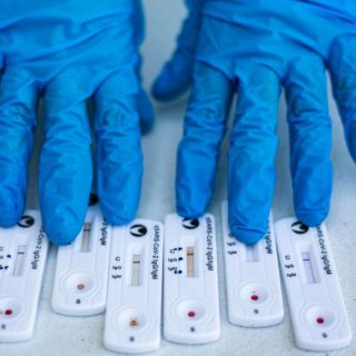 Suman 10 semanas de reducción continua de contagios: López-Gatell