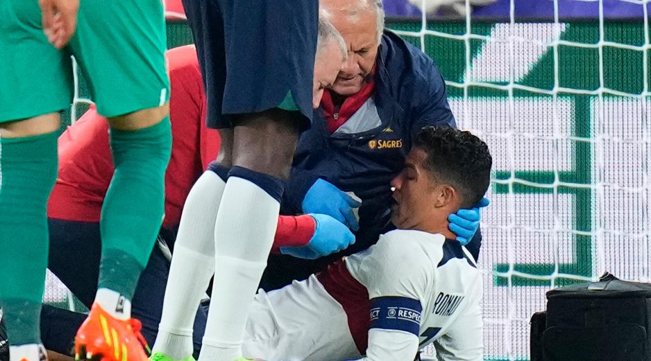 El impacto causó en el exjugador del Real Madrid una hemorragia en la nariz, misma que fue atendida rápidamente por los médicos. AP / D. Josek