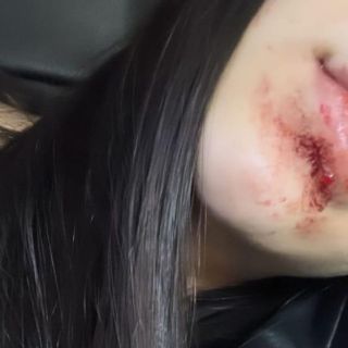 Kenia Os sufre desmayo y se golpea en el rostro