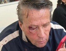 Adame fue intervenido en el hospital general Dr. Gea González por las cuatro fracturas en su rostro, así como las lesiones que tenía en el ojo derecho luego de que fuera agredido en la alcaldía Tlalpan de la Ciudad de México. ESPECIAL