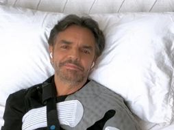 Derbez sufrió un accidente en su brazo que lo llevó a ser hospitalizado. ESPECIAL/Instagram