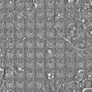 Ciencia médica: ¡Increíble! Neuronas de laboratorio aprenden a jugar un videojuego