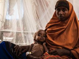 Muchos niños tienen graves problemas de salud debido a la falta de alimentos en Somalia. GETTY IMAGES