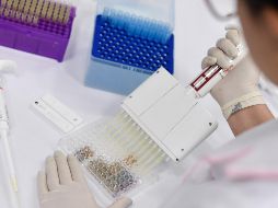 Hasta el día de hoy, Jalisco acumula 350 casos positivos de viruela del mono, con una carga mayor entre varones. AFP / ARCHIVO