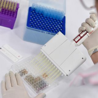 Avanza análisis para detección de viruela del mono en Jalisco