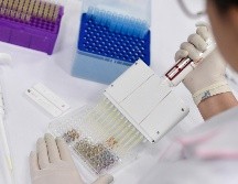 Hasta el día de hoy, Jalisco acumula 350 casos positivos de viruela del mono, con una carga mayor entre varones. AFP / ARCHIVO