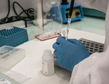 De acuerdo con información preliminar, la OMS estará publicando la lista actualizada de los patógenos potencialmente pandémicos antes de abril de 2023. AFP/ ARCHIVO