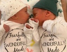 Lydia Ann y Timothy Ronald Ridgeway nacieron el 31 de octubre de 2022. EPA