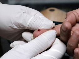 Hoy se conmemora el Día Mundial de la lucha contra el SIDA. EL INFORMADOR/ARCHIVO