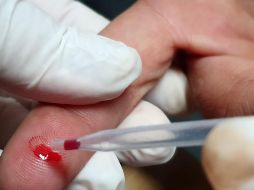 En México han padecido esta enfermedad cerca de 342 mil individuos. NTX/ARCHIVO