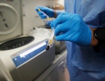 Cabe destacar que la Unidad de VIH trabaja en nuevas investigaciones como el protocolo de la vacuna contra VIH 