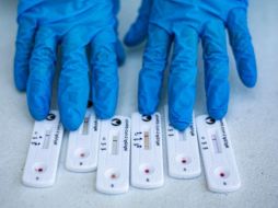 Los casos de COVID han tenido u alza en Jalisco debido al frío. EL INFORMADOR/ ARCHIVO