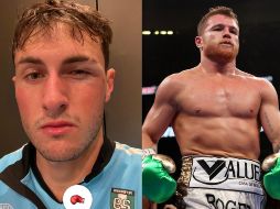 Fue en Instagram donde Santiago Giménez compartió una foto de su cara, donde se aprecia su ojo hinchado tras recibir un fuerte golpe. ESPECIAL