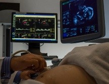 El Hospital Civil tiene un programa de Cirugía y Terapia Fetal. ARCHIVO