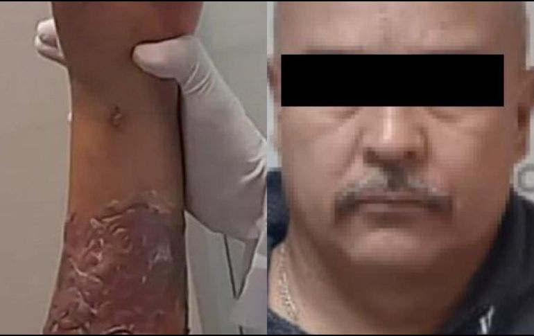 Roberto F., de 49 años de edad, está acusado de quemar a la menor de 11 años en julio pasado, dentro de un albergue en Tonalá. ESPECIAL