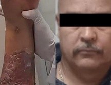 Roberto F., de 49 años de edad, está acusado de quemar a la menor de 11 años en julio pasado, dentro de un albergue en Tonalá. ESPECIAL