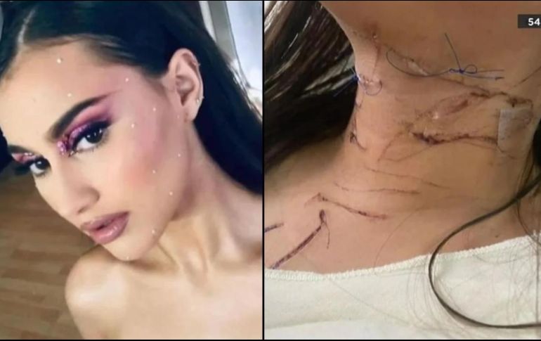 Mya Naomi fue víctima de intento de feminicidio por parte de su novio, ambos de 17 años, quien la apuñaló 47 veces en la cabeza, cuello, tórax, espalda, brazos y manos. SUN
