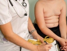 ¿Medidas drásticas? Así es cómo los pediatras tratan la obesidad infantil en EE.UU