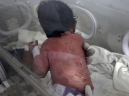 La pequeña tenía síntomas de hipotermia y presentaba varias contusiones, pero su estado era estable. AP/G. Alsayed