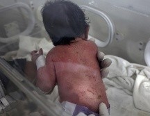 La pequeña tenía síntomas de hipotermia y presentaba varias contusiones, pero su estado era estable. AP/G. Alsayed