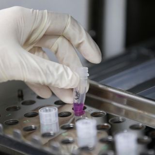 Registran más de 60 casos de viruela del mono en los últimos 14 días