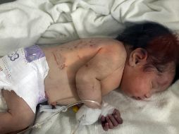 La bebé fue trasladada a Afrín, donde permanece desde entonces recibiendo tratamiento médico. AP/ARCHIVO