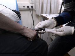 Existen dos casos previos considerados como de curación de VIH, el paciente de Berlín (confirmado el 2011) y el de Londres (2020), que, como el de Düsseldorf, pasaron por un trasplante de células madre. AFP / ARCHIVO