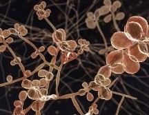 Los hongos del género Sporothrix, que se encuentran en el suelo y en algunas plantas ayudan a descomponer la materia orgánica en la naturaleza. GETTY IMAGES