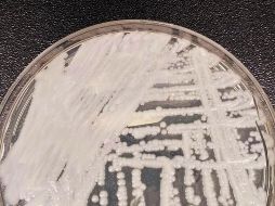 CÁNDIDA AURIS. Se identificó por primera vez en Japón en 2009 y cada vez se ve más en otros países. El primer caso en Estados Unidos fue en 2013, pero no se reportó hasta 2016. AP