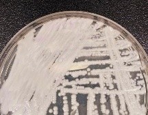 CÁNDIDA AURIS. Se identificó por primera vez en Japón en 2009 y cada vez se ve más en otros países. El primer caso en Estados Unidos fue en 2013, pero no se reportó hasta 2016. AP